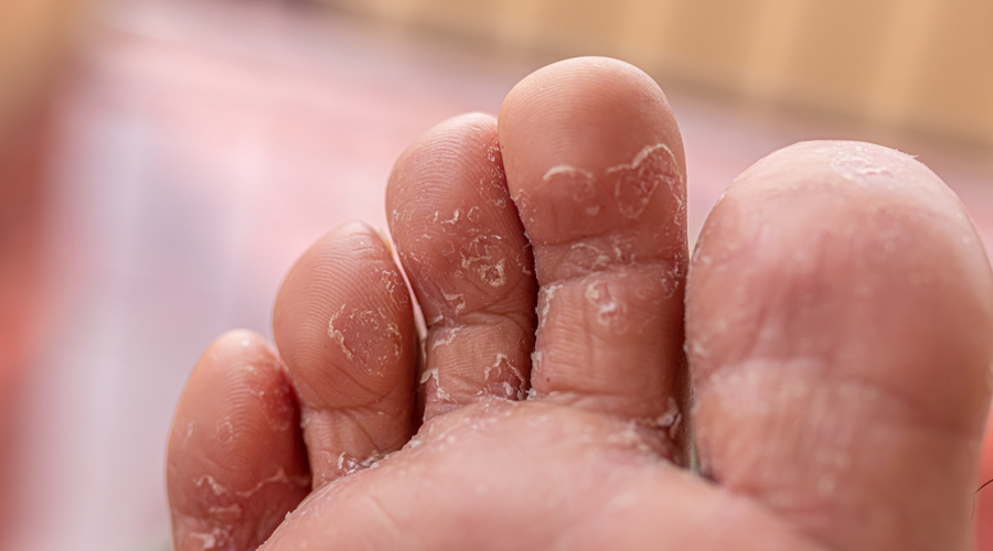 Enfermedades de la piel las más comunes y cómo identificarlas